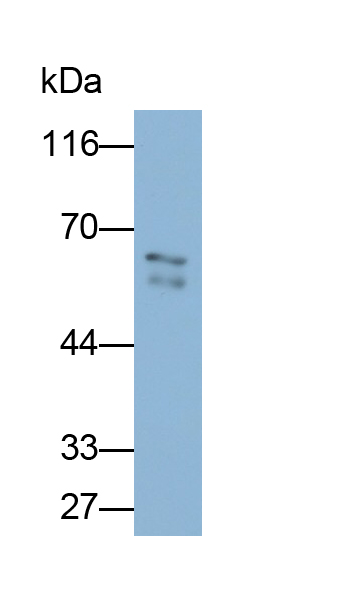 Polyclonal Antibody to Lipolysis Stimulated Lipoprotein Receptor (LSR)