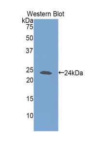 Polyclonal Antibody to Glutathione Synthetase (GSS)