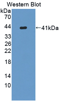 Polyclonal Antibody to Keratin 6C (KRT6C)