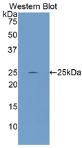 Polyclonal Antibody to Glutamate Cysteine Ligase, Catalytic (GCLC)