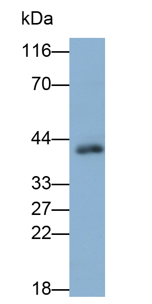 Polyclonal Antibody to Glutamine synthetase (GS)