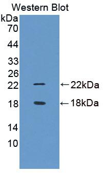 Polyclonal Antibody to Arginine Vasopressin Induced Protein 1 (AVPI1)