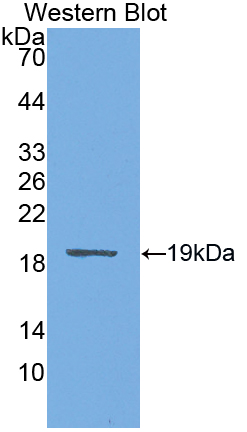 Polyclonal Antibody to Preprovasopressin (VP)