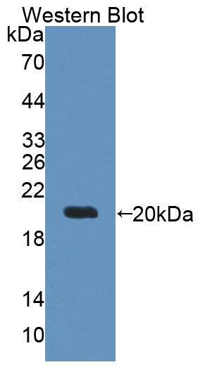 Polyclonal Antibody to Deoxythymidylate Kinase (DTYMK)