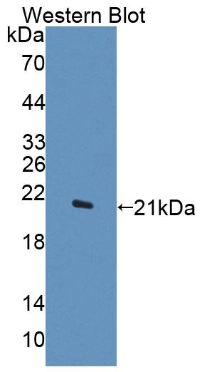 Polyclonal Antibody to Deoxythymidylate Kinase (DTYMK)