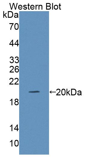 Polyclonal Antibody to Galanin Receptor 4 (GALR4)