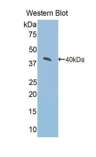 Polyclonal Antibody to Arginase II (Arg2)