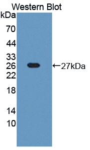 Polyclonal Antibody to Thrombospondin 2 (THBS2)