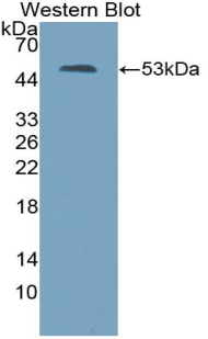 Polyclonal Antibody to Thrombospondin 2 (THBS2)