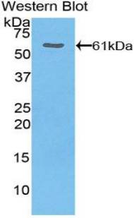 Polyclonal Antibody to Thrombospondin 4 (THBS4)