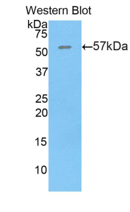 Polyclonal Antibody to Thrombospondin 4 (THBS4)