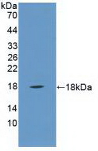 Polyclonal Antibody to Phospholipase A2, Group IIA (PLA2G2A)