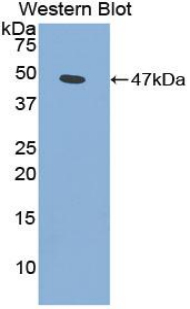 Polyclonal Antibody to Phospholipase A2, Group IIA (PLA2G2A)