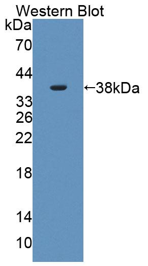 Polyclonal Antibody to Phospholipid Scramblase 4 (PLSCR4)