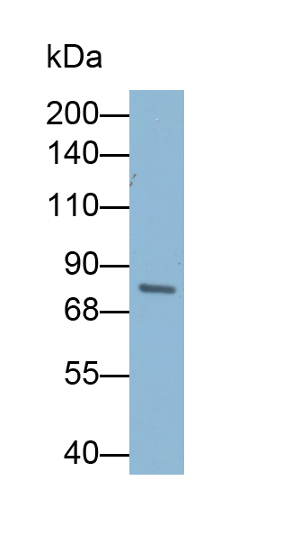 Polyclonal Antibody to Phospholipase A2 Receptor 1 (PLA2R1)