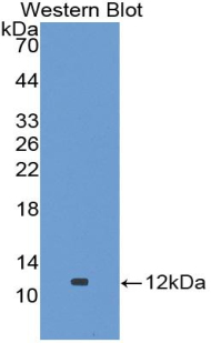 Polyclonal Antibody to Alanine Aminotransferase 2 (ALT2)