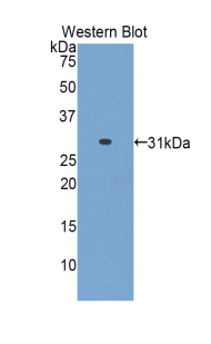 Polyclonal Antibody to Alanine Aminotransferase 2 (ALT2)