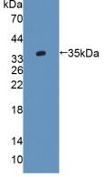 Polyclonal Antibody to Alanine Glyoxylate Aminotransferase 2 (AGXT2)
