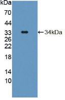 Polyclonal Antibody to Tyrosine Aminotransferase (TAT)