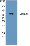 Polyclonal Antibody to Insulin Receptor Substrate 2 (IRS2)