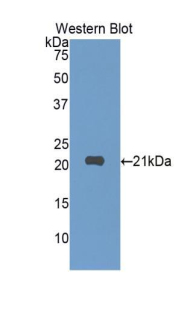 Polyclonal Antibody to Sialic Acid Binding Ig Like Lectin 10 (SIGLEC10)