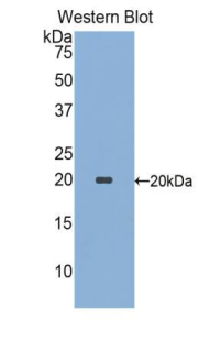Polyclonal Antibody to Sialic Acid Binding Ig Like Lectin 9 (SIGLEC9)
