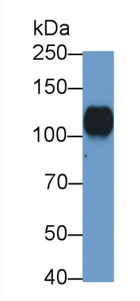 Polyclonal Antibody to Tumor Necrosis Factor Receptor Superfamily, Member 21 (TNFRSF21)