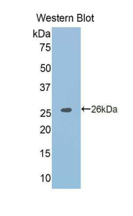 Polyclonal Antibody to Tumor Necrosis Factor Receptor Superfamily, Member 21 (TNFRSF21)