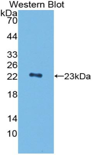 Polyclonal Antibody to Peptidoglycan Recognition Protein 1 (PGLYRP1)