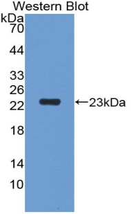 Polyclonal Antibody to Peptidoglycan Recognition Protein 1 (PGLYRP1)