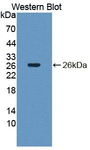 Polyclonal Antibody to 5',3'-Nucleotidase, Cytosolic (NT5C)