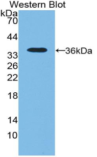 Polyclonal Antibody to 5'-Nucleotidase, Cytosolic III (NT5C3)