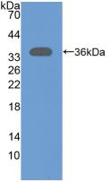 Polyclonal Antibody to 5'-Nucleotidase, Cytosolic III (NT5C3)