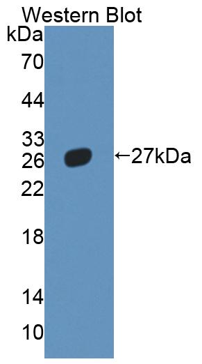 Polyclonal Antibody to Liver Receptor Homolog 1 (LRH1)