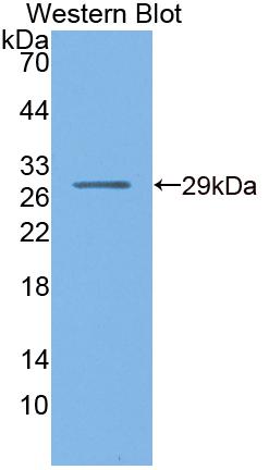 Polyclonal Antibody to Nuclear Receptor Subfamily 0, Group B, Member 1 (NR0B1)