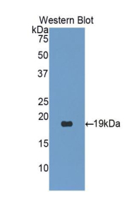 Polyclonal Antibody to Procollagen C Proteinase Enhancer 2 (PCPE2)