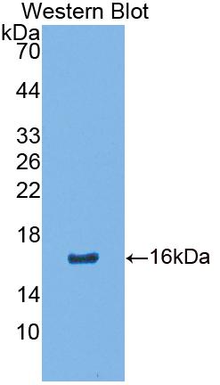 Polyclonal Antibody to Calcium Binding Protein 2 (CABP2)