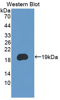 Polyclonal Antibody to Protocadherin 20 (PCDH20)