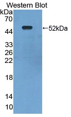 Polyclonal Antibody to Lactate Dehydrogenase D (LDHD)