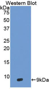 Polyclonal Antibody to Defensin Beta 103A (DEF<b>b103</b>A)