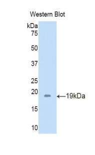Polyclonal Antibody to Lipocalin 6 (LCN6)