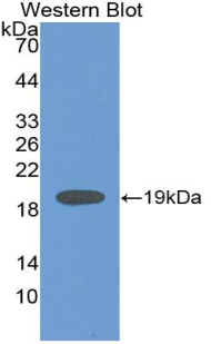 Polyclonal Antibody to Lipocalin 6 (LCN6)