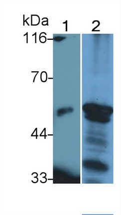 Polyclonal Antibody to Lipase I (LIPI)