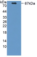 Polyclonal Antibody to Proprotein Convertase Subtilisin/Kexin Type 9 (PCSK9)