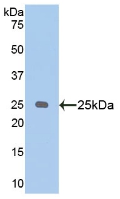 Polyclonal Antibody to Puromycin Sensitive Aminopeptidase (PSA)