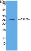 Polyclonal Antibody to Elastase 3B (ELA3B)