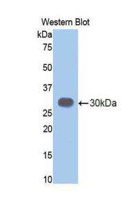 Polyclonal Antibody to Elastase 3B (ELA3B)