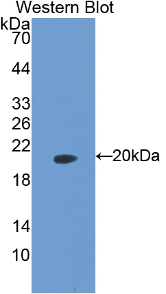 Polyclonal Antibody to Peptidyl Prolyl Cis/Trans Isomerase NIMA Interacting Protein 1 (PIN1)