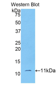 Polyclonal Antibody to Indoleamine-2,3-Dioxygenase 2 (IDO2)
