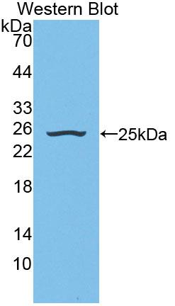 Polyclonal Antibody to Sialidase 2, Cytosolic (SIAL2)